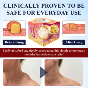 ATTDX® LipoEase Herbal Matrix