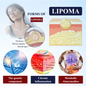 ATTDX® LipoEase Herbal Matrix