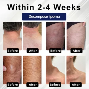 ATTDX® LipoEase Herbal Matrix