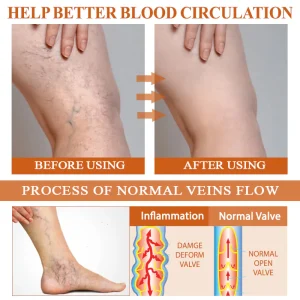 ATTDX® ManukaRelief Edema Therapy Cream