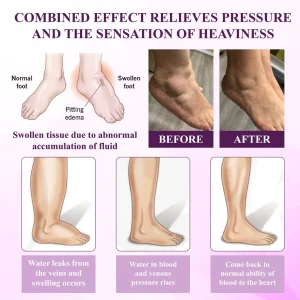 ATTDX® NightDrain Leg Therapy Edema Cream 17 ATTDX® NightDrain Leg Therapy Edema Cream