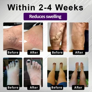 ATTDX® Night-Time Edema Relief Sleep Cream 12 ATTDX® Night-Time Edema Relief Sleep Cream