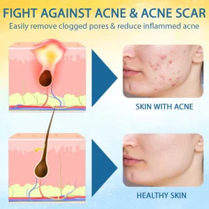 Croaie® PsoriasisCare Mellifera Venom Skin Healing Spray 18 Croaie® PsoriasisCare Mellifera Venom Skin Healing Spray