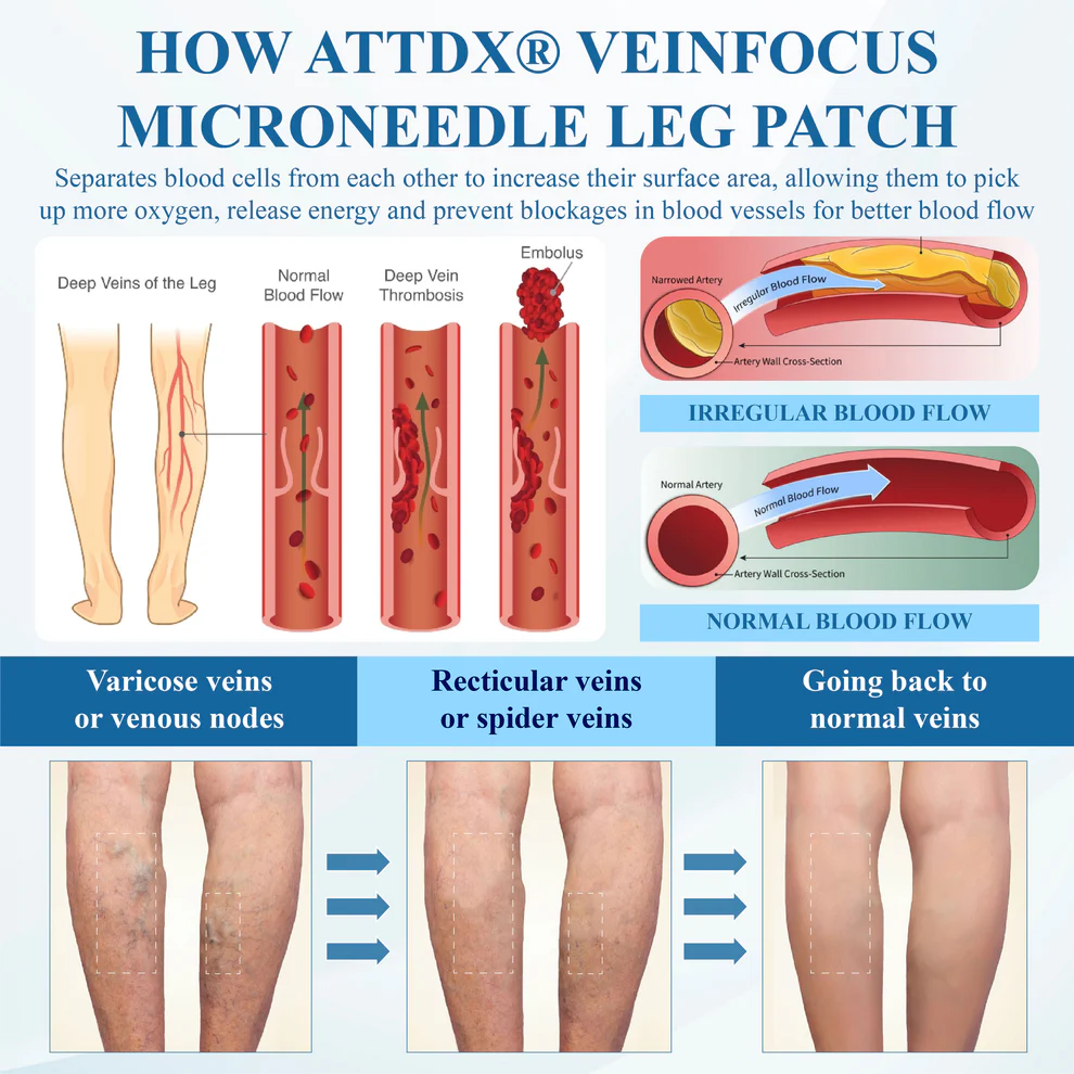 ATTDX® VeinFocus Microneedle Leg Patch 6 ATTDX® VeinFocus Microneedle Leg Patch