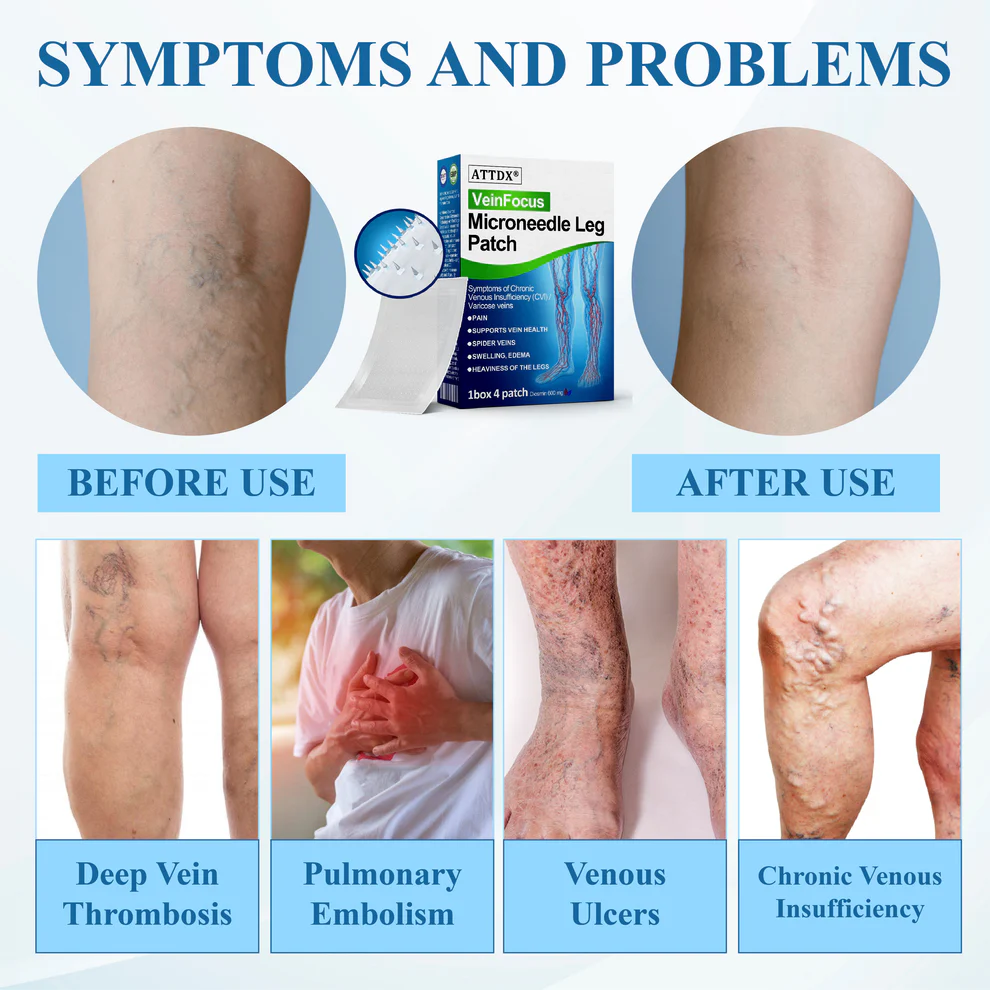 ATTDX® VeinFocus Microneedle Leg Patch 9 ATTDX® VeinFocus Microneedle Leg Patch