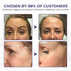 Brightmarsh® ElastaPro Emu Oil Skin Firming Cream 22 Brightmarsh® ElastaPro Emu Oil Skin Firming Cream