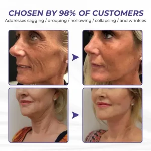 Brightmarsh® ElastaPro Emu Oil Skin Firming Cream 20 Brightmarsh® ElastaPro Emu Oil Skin Firming Cream