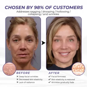 Brightmarsh® ElastaPro Emu Oil Skin Firming Cream 23 Brightmarsh® ElastaPro Emu Oil Skin Firming Cream