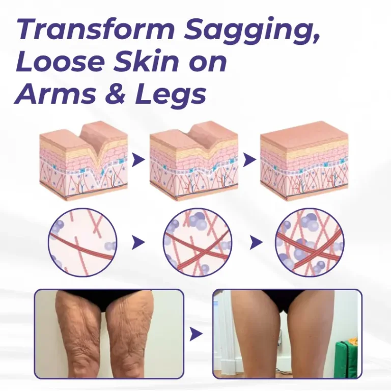 Brightmarsh® ElastaPro Emu Oil Skin Firming Cream 6 Brightmarsh® ElastaPro Emu Oil Skin Firming Cream