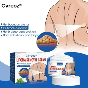 Cvreoz® Lipoma Removal Cream