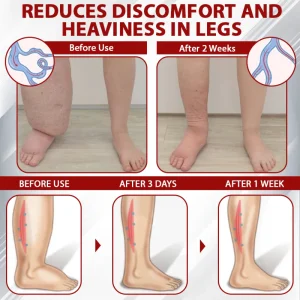 ATTDX® Red Vine FluidRelief Edema Gel 11 ATTDX® Red Vine FluidRelief Edema Gel