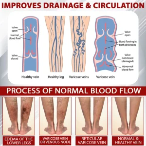 ATTDX® Red Vine FluidRelief Edema Gel 12 ATTDX® Red Vine FluidRelief Edema Gel