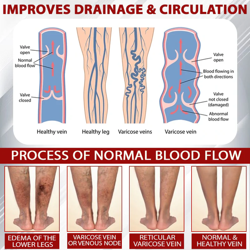 ATTDX® Red Vine FluidRelief Edema Gel 4 ATTDX® Red Vine FluidRelief Edema Gel