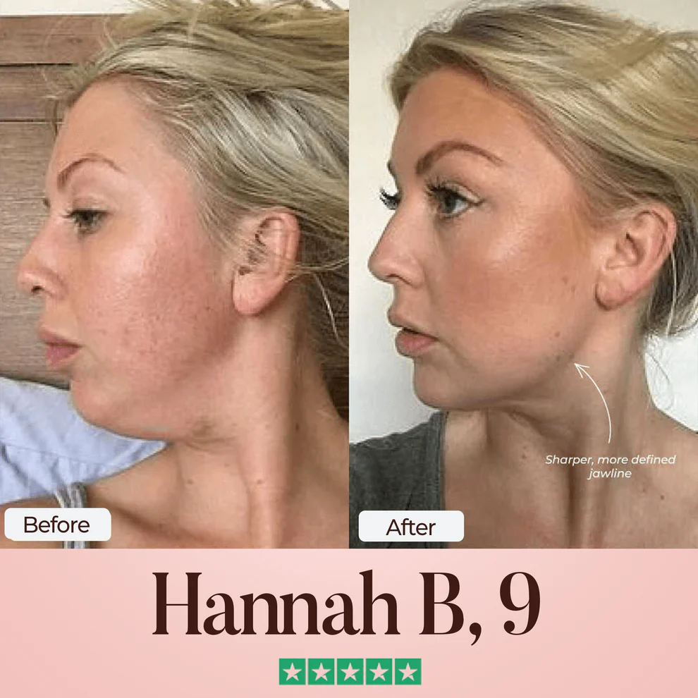 SculptFix™ Jawline Mask 5 SculptFix™ Jawline Mask