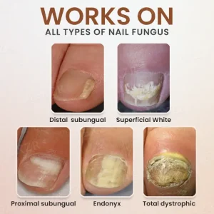 Piguiay® Nails Repairing Serum 13 Piguiay® Nails Repairing Serum