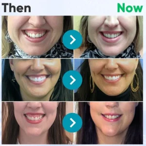 Dobshow® Bee Venom Dental Microgranules 11 Dobshow® Bee Venom Dental Microgranules