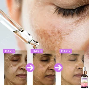 TAILEDEN® MelantraX Advanced Brightening Essence ACE