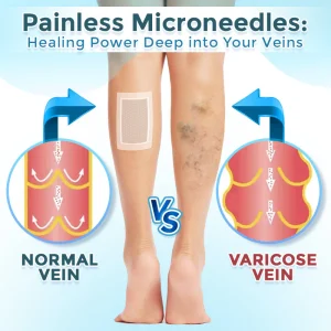 GFOUK® VenaRestore MicroNeedle Vein Repair Patch
