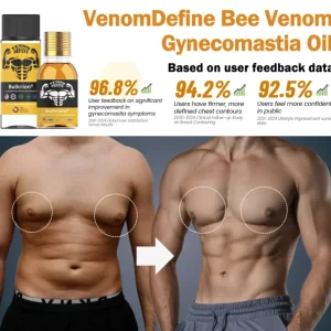 Bulkrion® Venom Define Bee Venom Gynecomastia Oil 6 Bulkrion® Venom Define Bee Venom Gynecomastia Oil