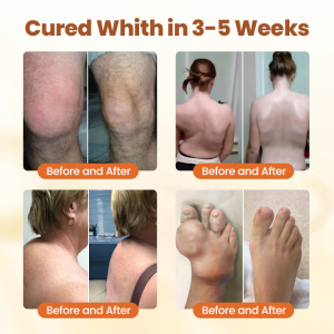 Caselast® Premium Curcumin Pain Relief Gel