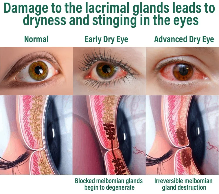 NESLEMY™ Nano Vision Repair Eye Serum 11 NESLEMY™ Nano Vision Repair Eye Serum