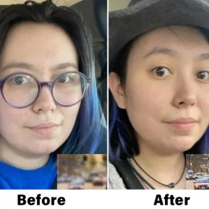 NESLEMY™ Nano Vision Repair Eye Serum 26 NESLEMY™ Nano Vision Repair Eye Serum