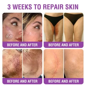 YUNPSO™ Queen Nectar Peptide + Bakuchiol Skin Restoration Cream 29 YUNPSO™ Queen Nectar Peptide + Bakuchiol Skin Restoration Cream