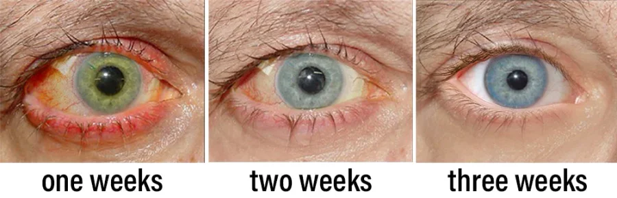 NESLEMY™ Nano Vision Repair Eye Serum 8 NESLEMY™ Nano Vision Repair Eye Serum