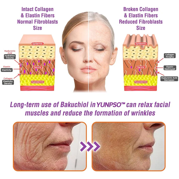 YUNPSO™ Queen Nectar Peptide + Bakuchiol Skin Restoration Cream 18 YUNPSO™ Queen Nectar Peptide + Bakuchiol Skin Restoration Cream