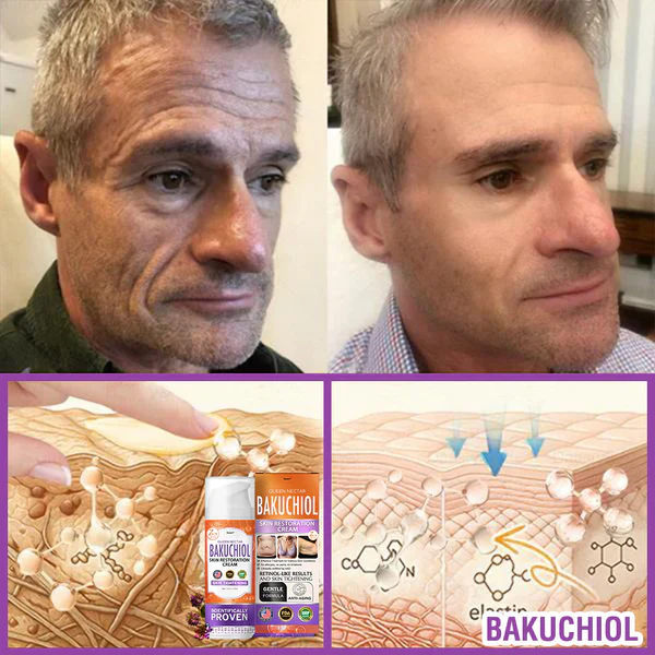 Furzero® Queen Nectar Peptide + Bakuchiol Skin Restoration Cream 11 Furzero® Queen Nectar Peptide + Bakuchiol Skin Restoration Cream - Image 11