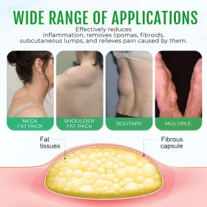 Cvreoz® DermaLump Relief Spray 11 Cvreoz® DermaLump Relief Spray