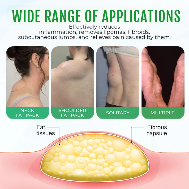 Cvreoz® DermaLump Relief Spray 2 Cvreoz® DermaLump Relief Spray