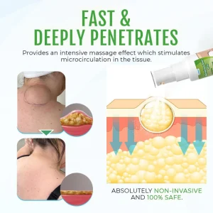 Cvreoz® DermaLump Relief Spray 15 Cvreoz® DermaLump Relief Spray