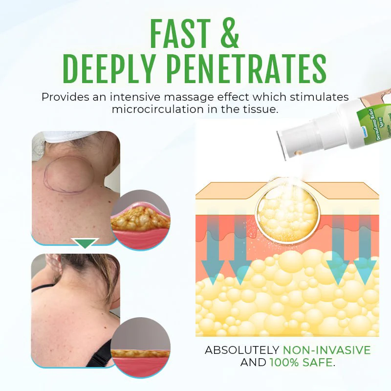 Cvreoz® DermaLump Relief Spray 6 Cvreoz® DermaLump Relief Spray