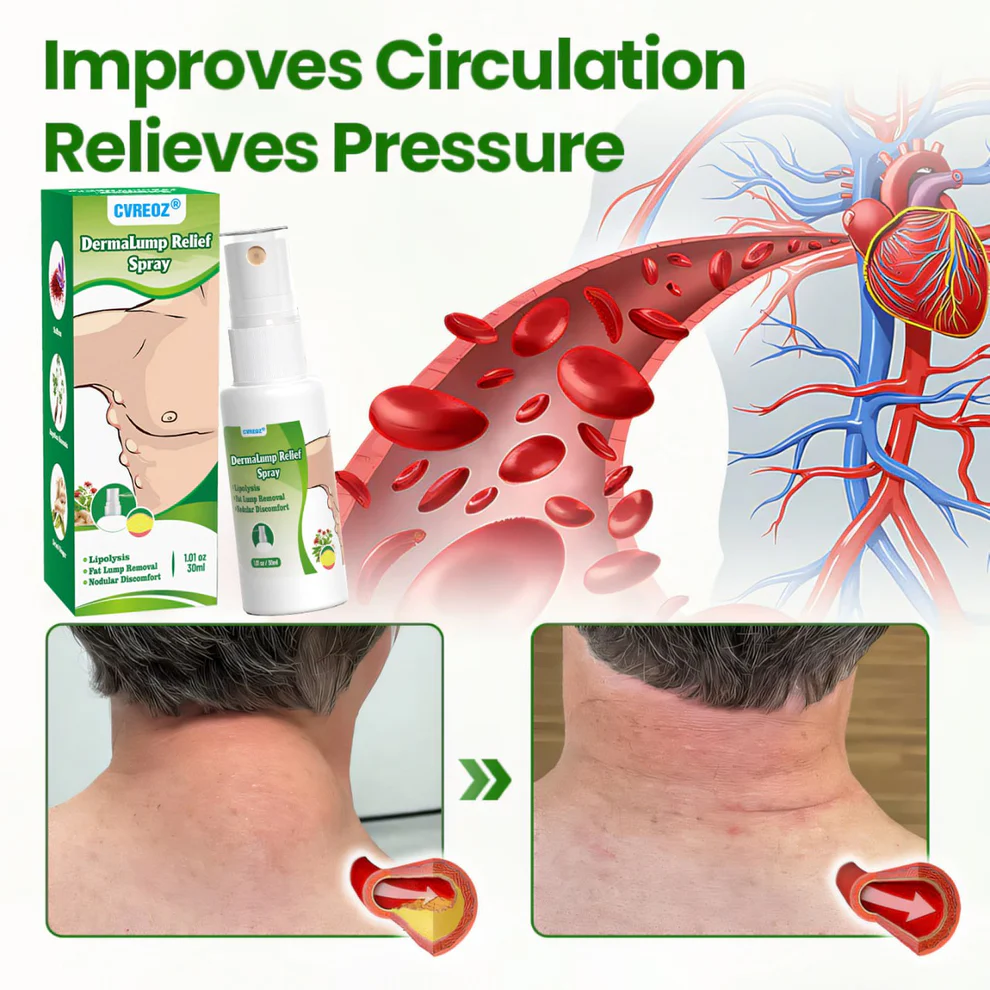 Cvreoz® DermaLump Relief Spray 5 Cvreoz® DermaLump Relief Spray