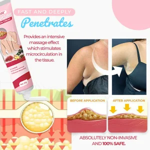 CVREOZ® LumpCure Lipoma Cream 11 CVREOZ® LumpCure Lipoma Cream