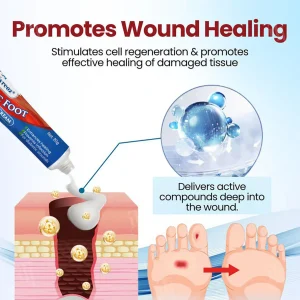 Cvreoz® Diabetic Foot Ulcer Repair Cream 14 Cvreoz® Diabetic Foot Ulcer Repair Cream