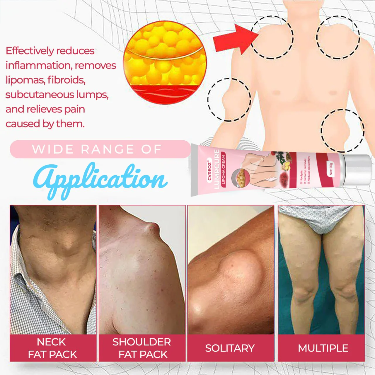 CVREOZ® LumpCure Lipoma Cream 5 CVREOZ® LumpCure Lipoma Cream - Image 5