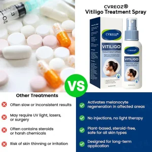Cvreoz® Vitiligo Treatment Spray 14 Cvreoz® Vitiligo Treatment Spray