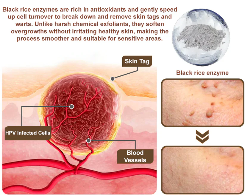 LOVILDS® Black Rice Skin Repair Essence Cream 10 LOVILDS® Black Rice Skin Repair Essence Cream