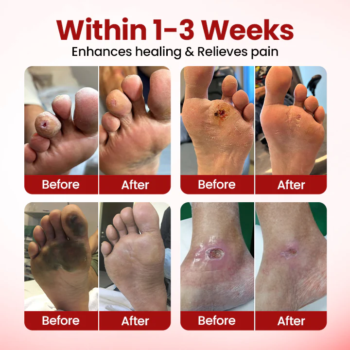 Yagoo® VitaGluco Diabetic Care Cream 2 Yagoo® VitaGluco Diabetic Care Cream