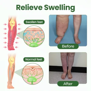 Timilk® BodyRelief Circulation Cream 16 Timilk® BodyRelief Circulation Cream