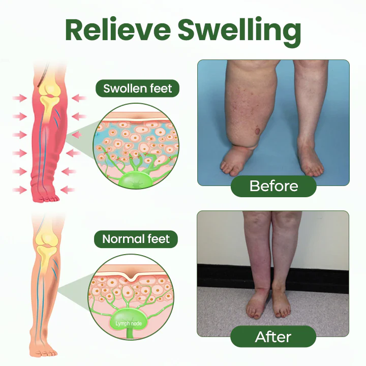 Timilk® BodyRelief Circulation Cream 8 Timilk® BodyRelief Circulation Cream