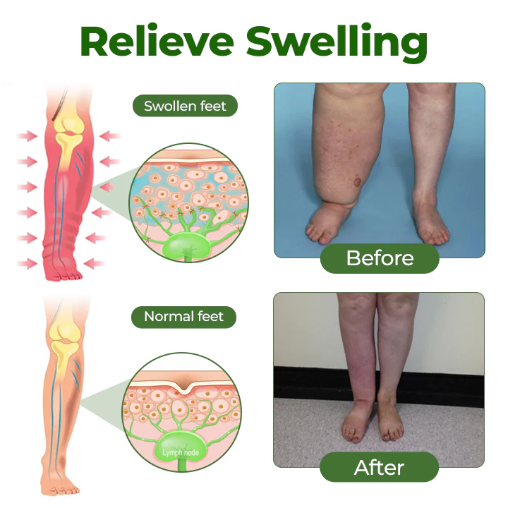 BBOJI® Professional Leg Circulation Cream 4 BBOJI® Professional Leg Circulation Cream