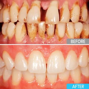 Lyyeto® Focussmile bee venom treatment powder for oral use 9 Lyyeto® Focussmile bee venom treatment powder for oral use