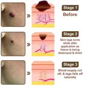 LOVILDS® Black Rice Skin Repair Essence Cream 27 LOVILDS® Black Rice Skin Repair Essence Cream