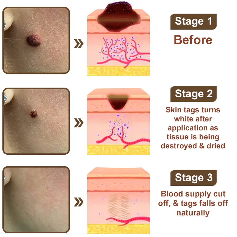 LOVILDS® Black Rice Skin Repair Essence Cream 11 LOVILDS® Black Rice Skin Repair Essence Cream