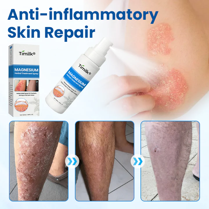 Timilk® Magnesium Herbal Treatment Spray 8 Timilk® Magnesium Herbal Treatment Spray