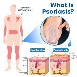 Timilk® Magnesium Herbal Treatment Spray 17 Timilk® Magnesium Herbal Treatment Spray