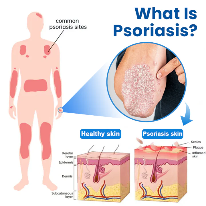 Timilk® Magnesium Herbal Treatment Spray 5 Timilk® Magnesium Herbal Treatment Spray